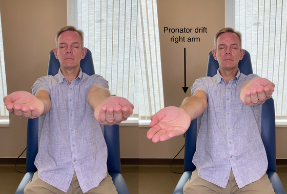 Two hands held up with their palms facing opposite directions