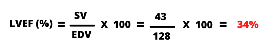 what-is-ejection-fraction-formula