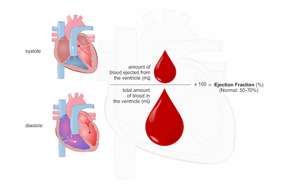 Heart Function Including Ejection Fraction (EF) • MyHeart