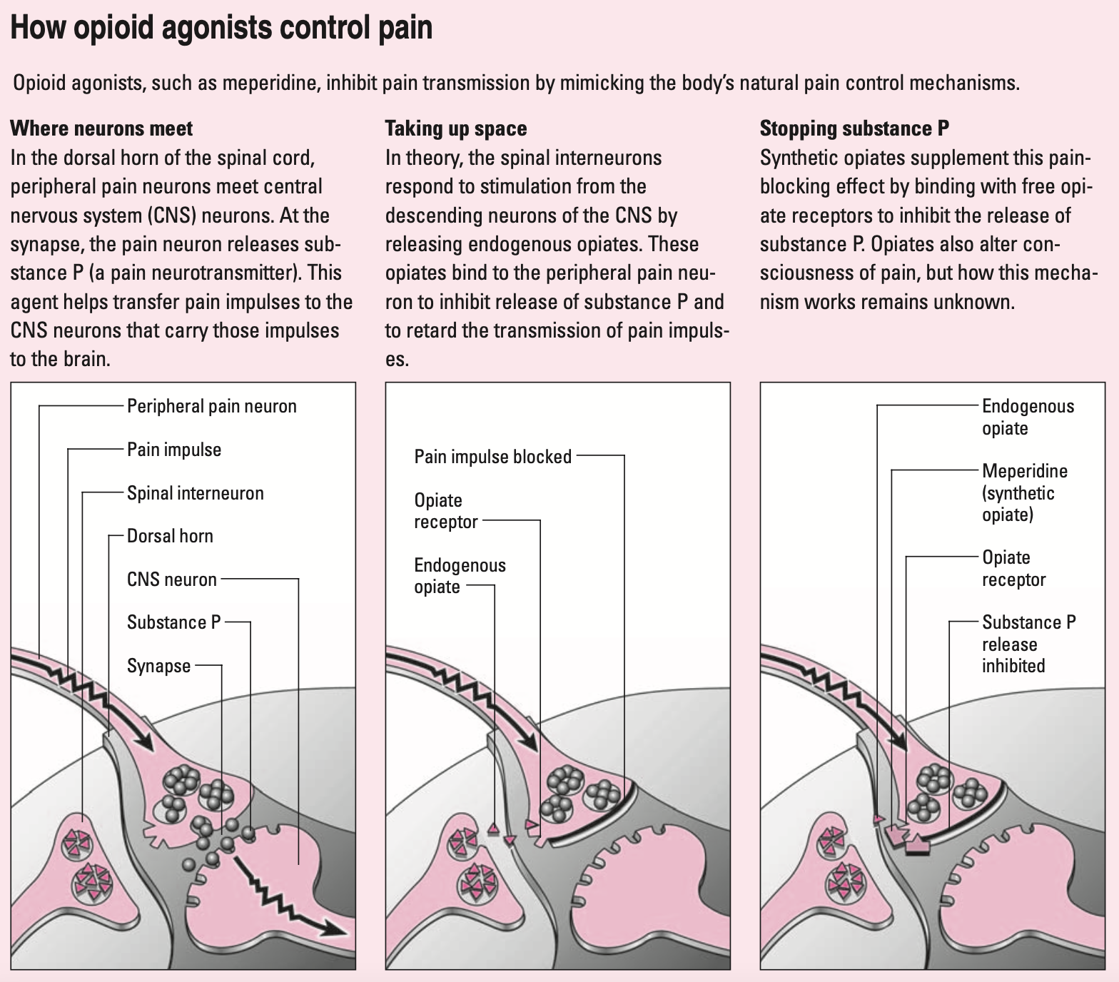 Opioid Agonists – How Do They Work? | Lippincott NursingCenter