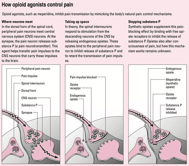 Opioid agonists – how do they work? - Sentinel Nurse